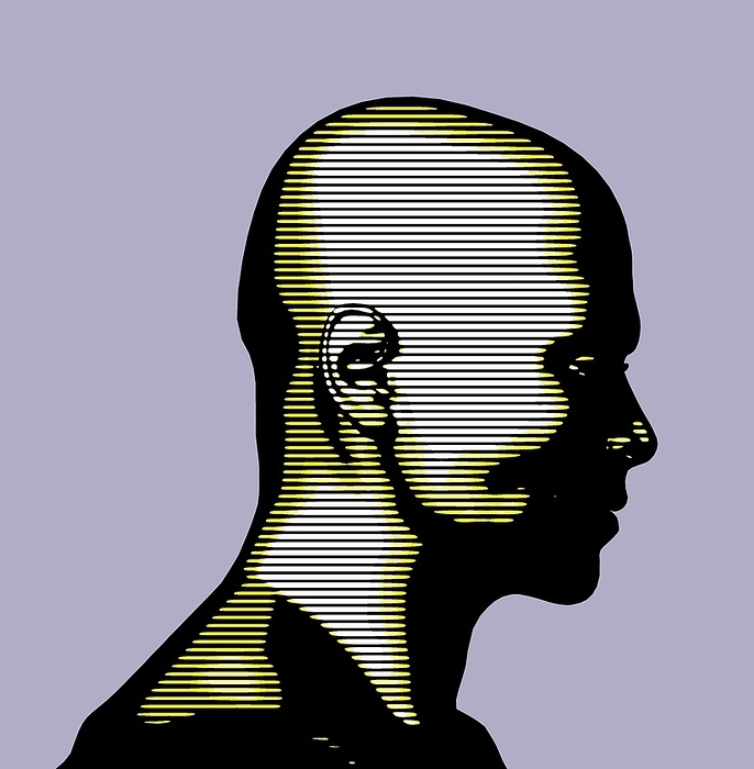 Depression, conceptual artwork Depression. Conceptual artwork of a male head in profile and in shadows, with the colours representing depression. This is a state of low mood, often accompanied by an aversion to activity, that can affect a person s physical and mental health.