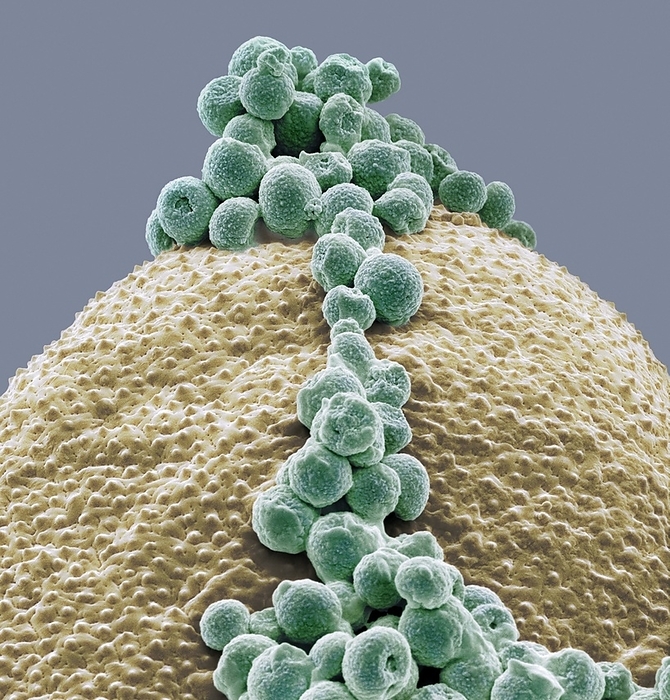 Fungal spores on pollen grain, SEM Fungal spores on pollen grain. Coloured scanning electron micrograph  SEM  showing fungal spores  round  on a pollen grain from a goji berry  wolfberry, Lycium sp.  plant. Magnification: x3300 when printed 10 centimetres wide.