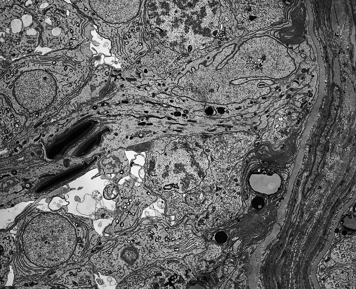 Sertoli cell, TEM Sertoli cell. Transmission electron micrograph  TEM  of a section through a Sertoli cell in the epithelium  lining  of a seminiferous tubule of a testis  testicle . The main function of Sertoli cells is to nourish the developing sperm cells through the stages of spermatogenesis  sperm maturation . They are activated by follicle stimulating hormone  FSH . Here, several elongating spermatids are embedded in deep crypts within the Sertoli cell cytoplasm, an arrangement that facilitates the release of fully developed spermatids during the process of spermiation. Spermatocytes and several round spermatids are also shown. Magnification: x2,000 when printed 10 centimetres wide.