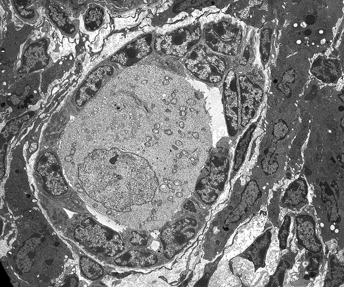 Ovarian follicle, TEM Ovarian follicle. Transmission electron micrograph  TEM  of a section through an ovary, showing a primary follicle. Primary follicles contain a central oocyte  female germ cell, egg  surrounded by a single layer of cuboidal granulosa cells. These follicles have developed from earlier and less mature primordial follicles, and have entered the process of folliculogenesis whereby they enlarge and mature into more advanced follicle types. Completion of folliculogenesis results in ovulation of the oocyte. Granulosa cells also termed follicle cells, respond to follicle stimulating hormone  FSH  by secreting oestrogen hormones necessary for follicle growth and maintenance of estrogen dependant organs in the body. Magnification: x2,000 when printed at 10 centimetres wide.