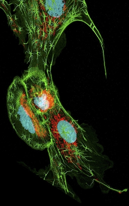 Lung cells, fluorescent micrograph Lung cells. Confocal laser scanning micrograph of bovine pulmonary artery epithelial cells. The cell nuclei, which contain the cells  genetic information, are blue. Actin filaments are green. Actin forms part of the cytoskeleton, which maintains the cells  shape, allows some cellular mobility and is involved in intracellular transport. Mitochondria, which produce energy for the cell, are red. Bovine pulmonary artery epithelial cells