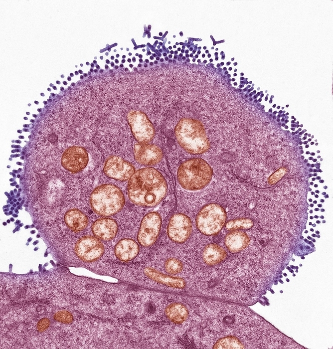 Vesicular stomatitis virus, TEM Vesicular stomatitis virus. Coloured transmission electron micrograph  TEM  of vesicular stomatitis virus  VSV  particles  purple  budding from a host cell  pink . Viruses replicate using the host cell s genetic machinery. These virus particles have formed in a cultured cell. VSV is a disease that infects sheep, horses and goats, and is similar to foot and mouth disease. VSV is a virus in the family Rhabdoviridae. Magnification: x10, 000 when printed at 10 centimetres wide.