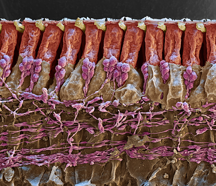 Organ of Corti, SEM Coloured scanning electron micrograph  SEM  of a section through the organ of Corti in the cochlear of the inner ear. Outer hair cells  red  are across top, with their nerve fibres  pink  below them. Around the nerve fibres are Deiters , or phalangeal, cells  brown , a type of support cell. On top of the hair cells are hairs  stereocilia, white  that are surrounded by endolymph fluid. As sound enters the ear, it causes waves to form in the endolymph, which in turn causes these hairs to move. Outer hair cells amplify the vibrations, which are then picked up by inner hair cells  not seen  that transmit the signal to auditory nerve fibres. This amplification enhances the sensitivity and dynamic range of hearing. Magnification: x2,000 when printed at 15cm wide.