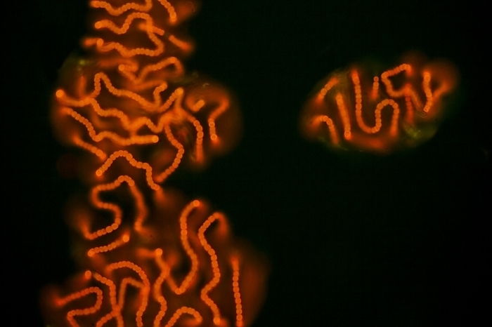Nostoc cyanobacteria, LM Light micrograph of Nostoc cyanobacteria, epi fluorescence. Filaments of round cells, surrounded by mucilage, showing orange Auto Fluorescence. Magnification 360x when printed at 10 centimetres wide.
