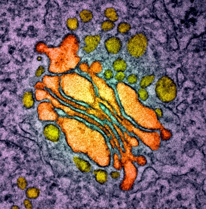 Golgi apparatus, TEM Golgi apparatus, coloured transmission electron micrograph  TEM . This intracellular stack of membranes  centre  make up an organelle that processes, modifies, and packages newly synthesised proteins.