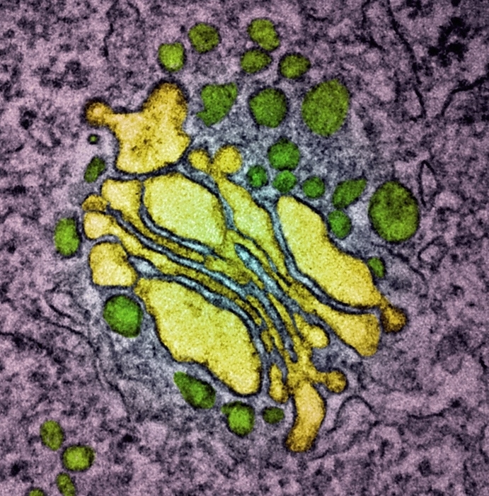 Golgi apparatus, TEM Golgi apparatus, coloured transmission electron micrograph  TEM . This intracellular stack of membranes  centre  make up an organelle that processes, modifies, and packages newly synthesised proteins.