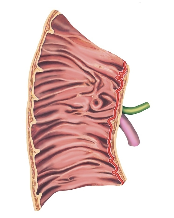 Duodenal mucosa relief, artwork Illustration of the Duodenal mucosa relief. This view illustration is from  Asklepios Atlas of the Human Anatomy .