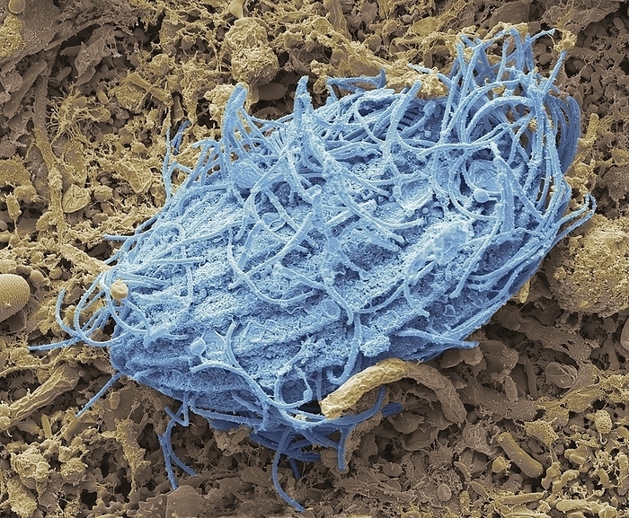 Ciliate protozoan in hedgehog faeces, SEM Ciliate protozoan in hedgehog faeces. Scanning electron micrograph  SEM . The European hedgehog  Erinaceus europaeus  is host to a wide variety of gut pathogens and parasites  helminths, nematodes, flukes, protozoans, and specific bacteria  the overburdening with which can significantly alter the fitness of the animal and also its suitability for release from wildlife rehabilitation centres. Magnification: x3000 when printed 10cm wide.