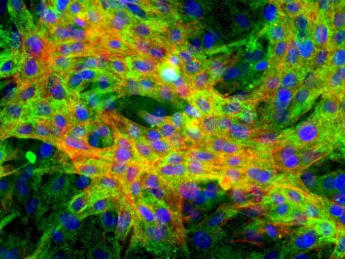 Heart muscle cells, light micrograph Heart muscle cells, fluorescence light micrograph. Cardiac muscle cells  cardiomyocytes  are found in the heart. Fluorescent markers have been used to highlight proteins in the cell nuclei  blue  and cytoskeleton  red and green . The proteins stained here are: actin  red  and desmin  green  to show the intermediate filaments of the cytoskeleton. These intermediate filaments are essential for the structural integrity and function of muscle. Cell nuclei have been stained with DAPI. This sample is from rat tissue.