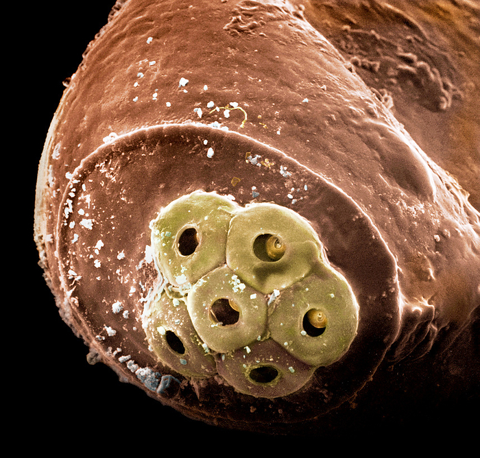 Head louse, SEM Scanning Electron Microscope Image of a head louse, Pediculus humanus capitis, egg  colourised .