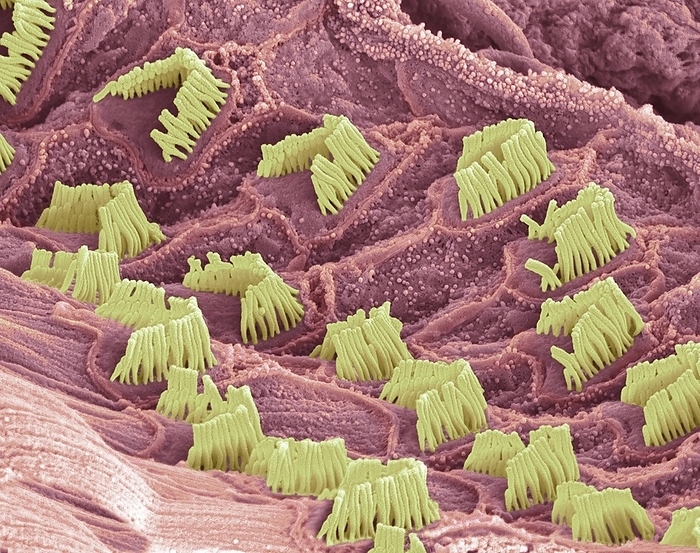 Organ of Corti, SEM Organ of Corti. Coloured scanning electron micrograph  SEM  of sensory hair cells from the organ of Corti, in the cochlea of the inner ear. These are the outer rows of hairs. These cells are surrounded by a fluid called the endolymph. As sound enters the ear it causes waves to form in the endolymph, which in turn cause these hairs to move. The movement is converted into an electrical signal, which is passed to the brain. Each V  shaped arrangement of hairs lies on the top of a single cell. Magnification: x8000 when printed 10cm wide.