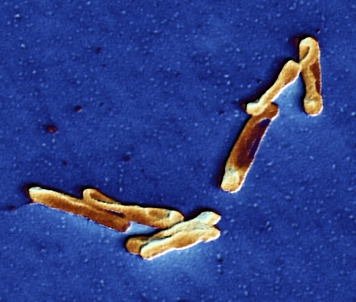 Clostridium difficile bacteria, TEM Clostridium difficile bacteria, coloured transmission electron micrograph  TEM . These rod shaped bacteria cause pseudomembranous colitis, one of the most common hospital acquired infections, and antibiotic associated diarrhoea. Infection can be fatal. Treatment is with antibiotic drugs, although this bacterium has become increasingly resistant to the use of antibiotics. Magnification: 5.000 x.