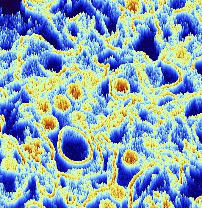Zika virus, TEM Coloured 3D plot oaf a transmission electron micrograph  TEM  of Zika virus particles  orange . Zika is an RNA  ribonucleic acid  virus from the Flaviviridae family. It is transmitted to humans via the bite of an infected Aedes sp. mosquito. It causes zika fever, a mild disease with symptoms including rash, joint pain and conjunctivitis. In 2015 a previously unknown connection between Zika infection in pregnant women and microcephaly  small head  in newborns was reported. This can cause miscarriage or death soon after birth, or lead to developmental delays and disorders. Magnification: x160, 000 when printed at 10 centimetres wide.