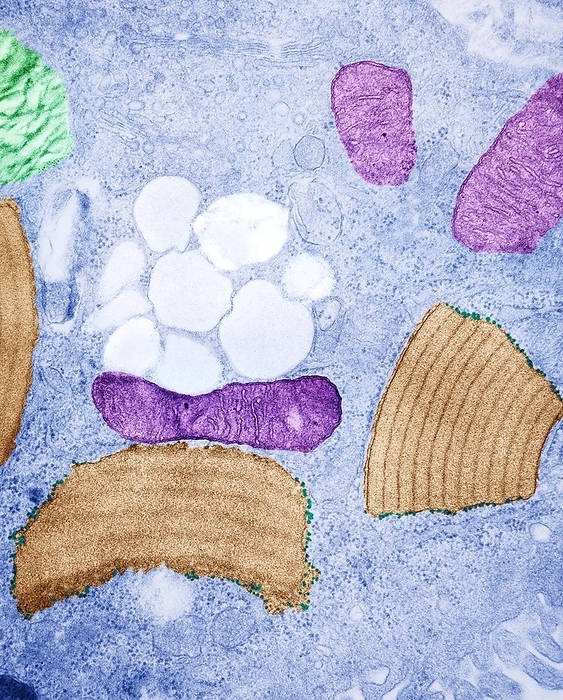 Alveolar cell, TEM Alveolar cell. Coloured transmission electron micrograph  TEM  of a section through a type II alveolar cell from a polecat  Mustela putorius , showing intracisternal protein paracrystals, mitochondria, lamellar bodies and ribosomes at either end of the intracisternal bodies. This cell is found in the alveoli  air sacs  of the lungs. It secretes surfactant, a substance that reduces surface tension in the air sac and prevents it from collapsing.