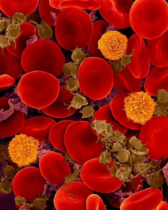 Red blood cells, T lymphocytes and activated platelets, SEM Human blood   red blood cells, 3 T lymphocytes and activated platelets, composite coloured scanning electron micrograph  SEM . Human red blood cells are the most abundant type of cell in human blood, accounting for 40  of the blood volume. Each cubic millimetre of blood contains around five million of these tiny, flexible disc shaped cells. The red colour comes from the iron containing protein haemoglobin, which picks up oxygen in the lungs and distributes it around the body. Because the cells have no nucleus and are subjected to constant physical action, they last only four months before being destroyed and broken down. T lymphocytes are involved in the specific immune response and are composed mainly of precursor T cells and B cells  pre T cells and pre B cells . Platelets are cell fragments in the blood that play an essential role in blood clotting and wound repair. Platelets can also activate certain immune responses. Magnification: x800 when shortest axis
