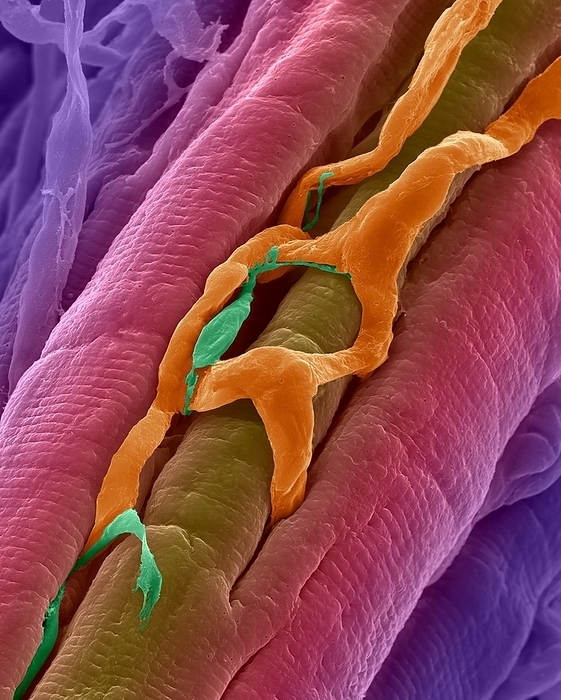 Heart muscle and capillaries, SEM Heart muscle with capillaries passing amongst the heart muscle fibres, coloured scanning electron micrograph  SEM . Note the small varicose purkinje fibre adjacent to part of the capillary. Purkinje fibres are modified cardiac muscle fibres which originate from the atrioventricular node and spread into the two ventricles. They transmit the electrical impulse from the atrioventricular node to the ventricles enabling their almost simultaneous contraction. The spread of excitation through the ventricles from the atrioventricular node is extremely rapid, moving at one to four meters per second. Magnification: x400 when shortest axis printed at 25 millimetres.