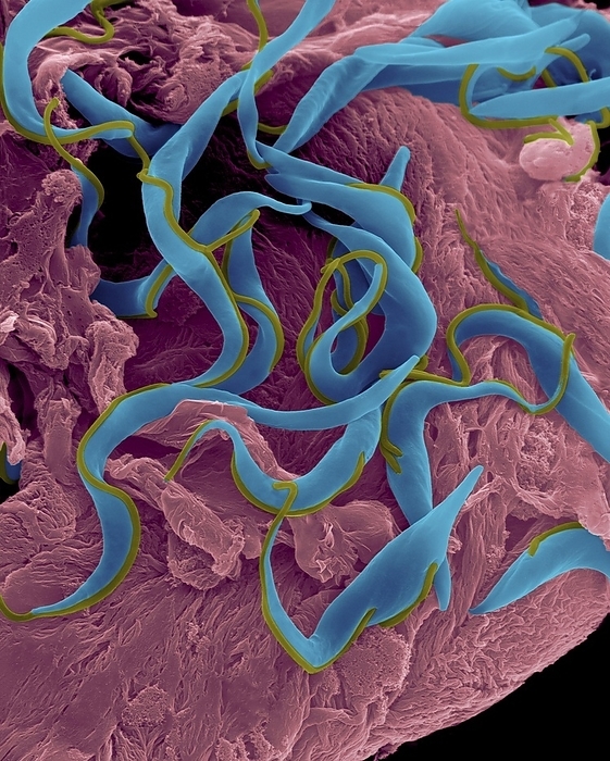 Trypanosome trypomastigote protozoan, SEM Trypanosome trypomastigote  Trypanosoma sp. , coloured scanning electron micrograph  SEM . A parasitic hemoflagellated protozoan that causes trypanosomiasis  African sleeping sickness, Chagas disease . This trypanosome is a vector borne parasite transmitted by tsetse flies  Glossina spp. . The ribbon like flagellated trypomastigote is carried in the insects saliva  and faeces  and enters the human host through a wound made by the fly. This protozoan infects the blood, lymph and spinal fluid and rapidly divides. Upon entering the cerebral spinal fluid the parasite can damage brain tissue causing eventually causing death. Magnification: x800 when shortest axis printed at 25 millimetres.