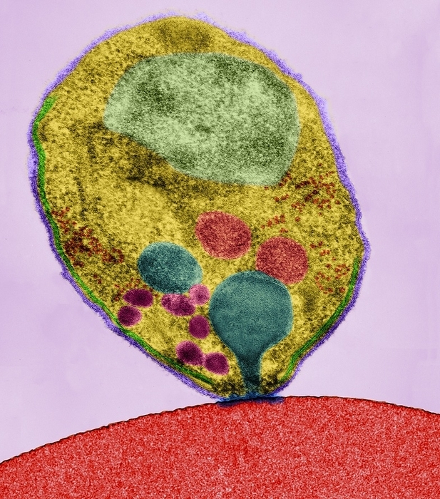 Plasmodium falciparum, TEM Plasmodium falciparum plasmodial merozoite making initial contact with an erythrocyte  red blood cell  membrane at the beginning of erythrocyte invasion, coloured transmission electron micrograph  TEM . The invasive merozoite has a distinct trilaminar membrane  green . The merozoite cytoplasm contains a rhoptry neck, or duct, and rhoptry bulbs  blue , a nucleus  ivory , ribosomes  orange , micronemes  purple  and mitochondria  dark pink . Malaria is caused by Plasmodium spp., protozoa. It is spread to humans by Anopheles species mosquitoes. The plasmodial parasite reproduces asexually in red blood cells significantly destroying many of them. Release of mature Plasmodium merozoites results in further infection and produces bouts of shivering fever  paroxysms  and sweating that may be fatal. Magnification: x5,840 when shortest axis printed at 25 millimetres.