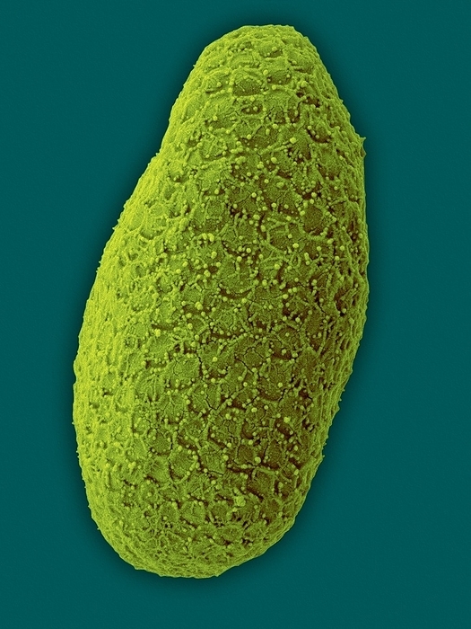 Pyramimonas sp., marine, scaled, green alga, SEM Coloured scanning electron micrograph  SEM  of Pyramimonas sp., flagellated, scale covered, marine, green alga. The genus Pyramimonas is a single celled alga that belongs to the group of green algae  Chlorophyta  called prasinophytes. The cell possesses one to many flagella for motility and contains only 1 2 chloroplasts for photosynthesis  not shown in this image . Some species supplement their nutrition by ingesting bacteria and other organic matter, a process called mixotrophy. The cell body is covered with cellulose scales in several layers. These scales can have a complex morphology. Pyramimonas species are abundant in marine plankton and are typically part of the nanoplankton of the sea. Magnification: x3,465 when shortest axis printed at 25 millimetres.