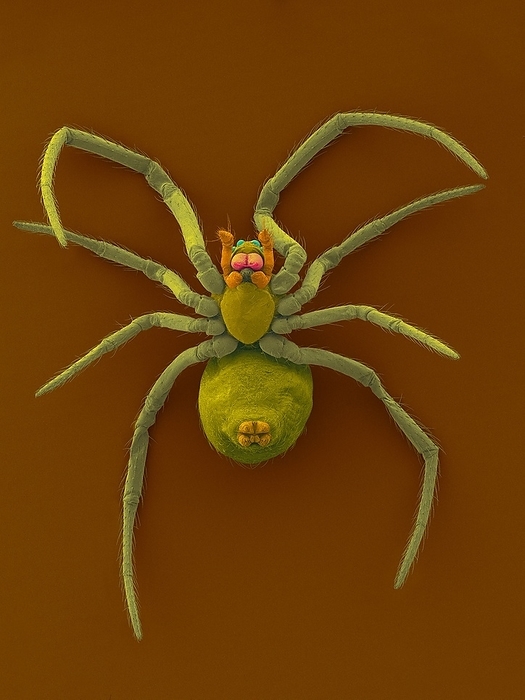Western black widow spiderling, SEM Coloured scanning electron micrograph  SEM  of Western black widow spiderling  Latrodectus hesperus . Latrodectus hesperus is a venomous spider found in the western regions of North America usually in warmer climates. This spider can be identified as a female by the red hourglass shape mark on the underside of her abdomen. The female black widow is dangerous to humans, as her bite contains a significant amount of nerve toxin  neurotoxin, latrotoxin . This neurotoxin causes pain and swelling, and in rare cases, may even be fatal. The genus gets its name from the female s practice of devouring the male after mating, although this behaviour is seen in other spiders. After the female and male mate, the female lays several bunches of egg sacs in the web, each containing about 750 eggs. Magnification: x6 when shortest axis printed at 25 millimetres.