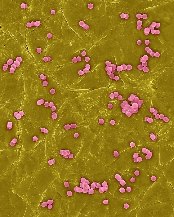 Enterococcus faecium on human skin, SEM Coloured scanning electron micrograph  SEM  of Photocomposite, Enterococcus faecium on the surface of human skin. Enterococcus faecium  also known as Streptococcus faecium , Gram positive, vancomycin resistant  VRE , coccus prokaryote that grows in groups or chains. E. faecium is commonly found in the guts of humans and other animals. It does not normally cause disease, but can be an opportunistic pathogen when the immune system is impaired. It is an important nosocomial  hospital acquired  pathogen. E. faecium is known to have a resistance to several types of antibiotics including gentamicin, tetracycline, erythromycin, teicoplanin and penicillin. Magnification: x800 bacteria  x200 skin when shortest axis printed at 25 millimetres.