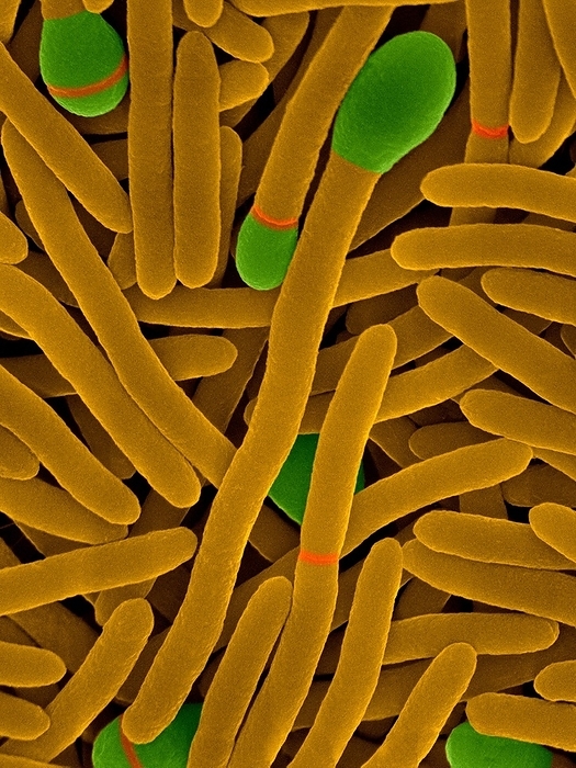 Clostridium phytofermentans, SEM Coloured scanning electron micrograph  SEM  of Clostridium phytofermentans, Gram positive, anaerobic, rod shaped prokaryote  bacterium . C. phytofermentans is a spore forming bacterium that naturally occurs amongst decomposing plant and animal matter. In this image both vegetative and spore forming cells  with rounded cell tips  are seen. C. phytofermentans is a soil bacterium that can utilize lignocellulose  a type of cellulose  to generate ethanol, thus making it a possible candidate for use in ethanol production. Cellulose is prominent in cell walls of higher plant life and thus is an important by product of agricultural and municipal waste. Microorganisms primarily carry out the decomposition of cellulose and this process is an important step in the cycling of carbon in the biosphere. Magnification: x6,665 when shortest axis printed at 25 millimetres.