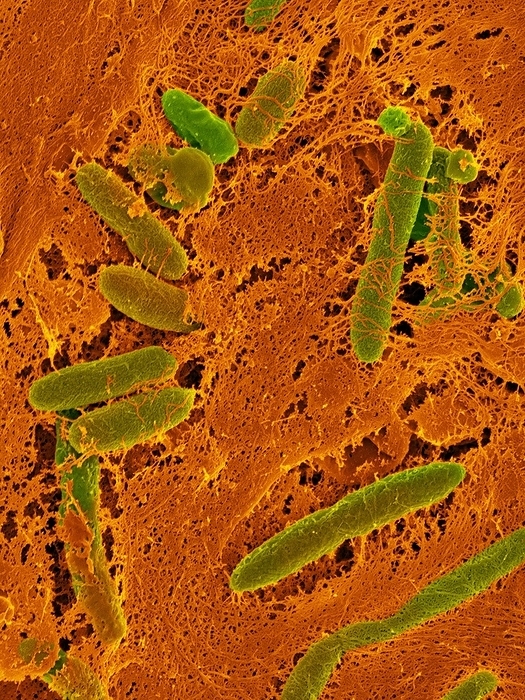 Shewanella putrefaciens, SEM Coloured scanning electron micrograph  SEM  of Shewanella putrefaciens  formerly known as Achromobacter putrefaciens or Pseudomonas putrefaciens  is a Gram negative, biofilm producing bacterium. It is also a facultative anaerobe, whereby it can undergo aerobic respiration when oxygen is present, and can reduce iron and manganese metabolically. It has been found in freshwater, brackish, and salt water ecosystems and occur in biofouling environments. S. putrefaciens is often associated with marine biofouling and has a odour of rotten fish due to its production of trimethylamines and hydrogen sulphide. It plays a major role in food spoilage in marine fish and may cause microbe induced corrosion on steel surfaces. Shewanella putrefaciens can be a human pathogen and can produce clinical diseases including bacteraemia and various soft tissue and intra abdominal infections. Magnification: x4,000 when shortest axis printed at 25 millimetres.