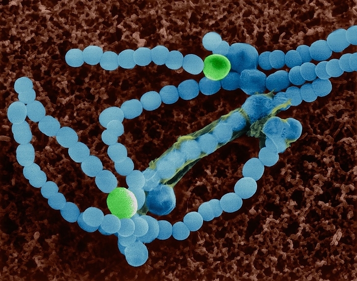 Cyanobacterium  Anabaena sp. , SEM Coloured scanning electron micrograph  SEM  of Anabaena sp., Gram negative, oxygenic, photosynthetic, nitrogen fixing, filamentous cyanobacterium  prokaryote . Note the larger cells in the filament called heterocysts which are involved in nitrogen fixation. Anabaena is a genus of filamentous cyanobacteria  formerly known as blue, Green algae . It found as planktonic cyanobacterium  all types of water  and is known for its nitrogen fixing abilities. Blooms or massive growths can occur in waters with a lot of nutrients. These blooms discolour the water and give it a bad odour when the cells die and decay. Anabaena is one of four genera of cyanobacteria that produce neurotoxins. These toxins are harmful to local wildlife, as well as farm animals and pets. Production of these neurotoxins is part of its symbiotic relationships it forms with certain plants. Some species of Anabaena are endophytes. Magnification: x660 when shortest axis printed at 25