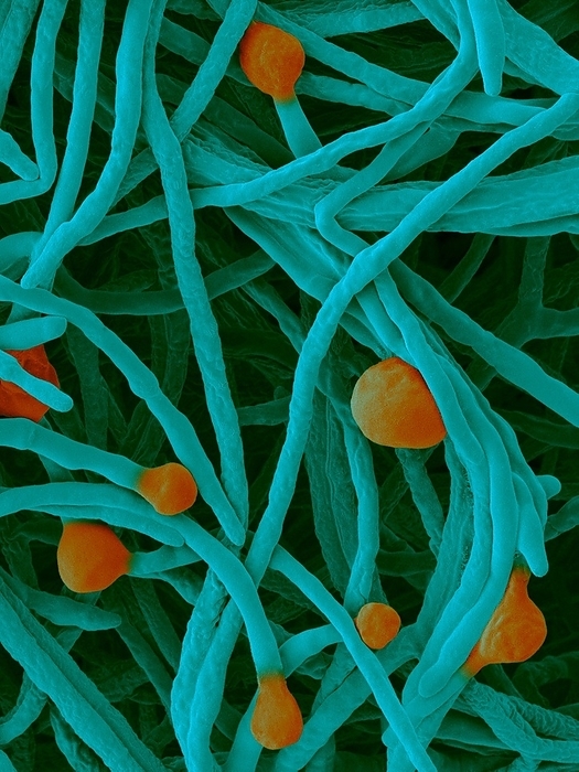 Phaeosphaeria microscopica, SEM Coloured scanning electron micrograph  SEM  of Phaeosphaeria microscopica is an ascomycete fungus that is a plant pathogen. P. microscopica causes the fungal plant disease, Microscopica Leaf Spot disease. Shown here are the hyphal filaments of the vegetative stage with newly forming fruiting bodies  sporocarps  ascocarps  at the tips of the hyphae. The developing ascocarp will produce thousands of ascospores  fungal spores . P. microscopica survives as pseudothecia on grass and wheat stubble. The disease occurs under continuous wet periods of 48 hours or more. The symptom on diseased leaves is yellow brown blotches. P. microscopica is especially destructive in wheat fields. Magnification: x585 when shortest axis printed at 25 millimetres.