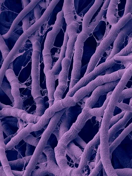 Basidiomycete Antrodia malicola, SEM Coloured scanning electron micrograph  SEM  of Antrodia malicola is a basidiomycete bracket fungus in the family Meripilaceae. Shown here is the vegetative hyphae of the mycelium possessing distinct septae. Antrodia species have fruiting bodies that typically lie flat or spread out on the growing surface, with the hymenium exposed to the outside. The edges may be turned so as to form narrow brackets of these bracket fungi. Most species are found in temperate and boreal forests, and cause brown rot. Some of the species in this genus are have medicinal properties. The genus Antrodia includes some medicinal fungi such as Antrodia camphorata   this species in particular is a well known medicinal mushroom in Taiwan  known as Niu Chang . It is commonly used as an anti cancer, anti itching, anti allergy, anti fatigue and liver protective drug. Magnification: x535 when shortest axis printed at 25 millimetres.