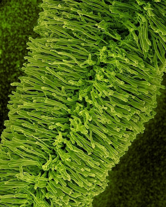 Bracket fungus basidiocarp lower surface, SEM Coloured scanning electron micrograph  SEM  of the bracket fungus basidiocarp  fruiting body  lower surface showing generative hyphae  gill, spore producing . Bracket fungi are so named because they occur as individual fruiting bodies  mushrooms  in a grouping or pattern known as a bracket. They generally cover a tree trunk in separate or connected horizontal rows. Oyster mushrooms are an example of delicate, edible bracket fungi, but shapes of other species vary from papery thin to thick, woody and large. Magnification: x70 when shortest axis printed at 25 millimetres.