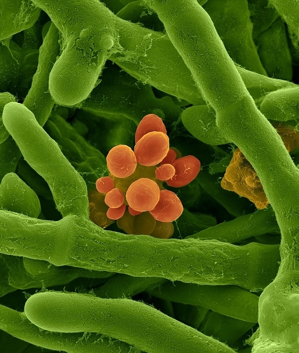 Allergenic mould Aureobasidium pullulans, SEM Coloured scanning electron micrograph  SEM  of the common indoor allergenic mould Aureobasidium pullulans. Seen here is fungal hyphae stage producing yeast buds. This species also grows as a yeast form under certain environmental conditions. Aureobasidium pullulans is also known as Pullularia pullalans . Aureobasidium is a common indoor mould that grows in damp places. It occurs indoors in very damp areas and in free standing water, such as condensate pans, or following a flood. Spores only become airborne through mechanical disruption of contaminated materials or aspiration of contaminated water. It is not a primary human pathogen nor is it recognized as a producer of significant mycotoxins. High airborne levels of this fungus have been associated with allergic complaints probably due to respiratory irritation mediated by cell wall components  e.g. beta glucans, glycoproteins Magnification: x800 when shortest axis printed at 25