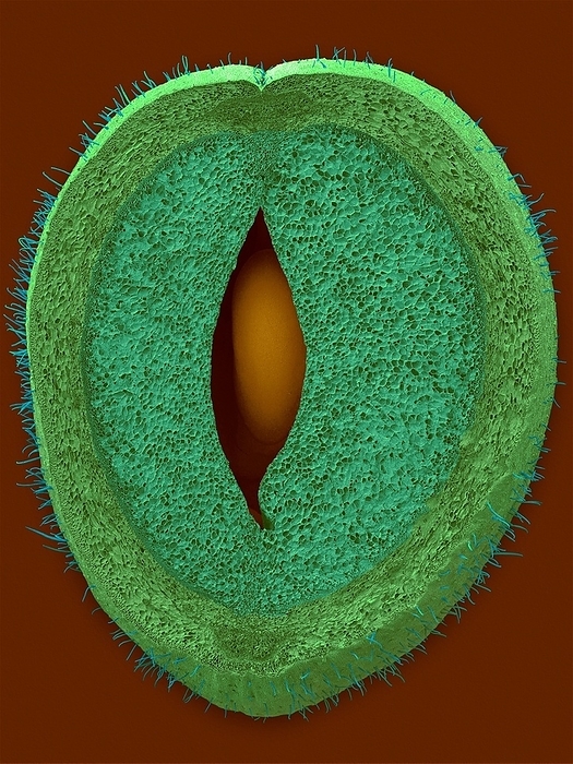 Green bean parenchyma cells and seed, SEM Green bean pod parenchyma cells and seed  Phaseolus vulgaris  Blue Lake variety , coloured scanning electron micrograph  SEM . Shown here is a fresh cross section through a green string bean pod revealing a bean seed surrounded by parenchyma cell tissue. The been pod tissue is composed of inner and outer parenchyma cells. The outer parenchyma cells have large substomatal and intercellular spaces surrounded by a thick wall hypodermis. Cells of the outer parenchyma contain numerous starch granules and are thicker walled than the inner parenchyma cells. The inner parenchyma cells are thin walled and form a compact, succulent tissue with only small intercellular spaces. They contain some starch granules and they compose the inner bean pod tissue that surrounds the bean seeds. Magnification: x6 when shortest axis printed at 25 millimetres.