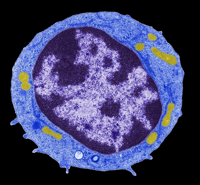 Lymphocyte, TEM Lymphocyte. Coloured transmission electron micrograph  TEM  showing the large central nucleus  purple  of a lymphocyte  white blood cell . Surrounding this is the cytoplasm  blue , containing mitochondria  yellow . Lymphocytes are cells of the human immune system. They are produced in bone marrow and mature in the thymus gland. T lymphocytes are susceptible to infection by the Human Immunodeficiency Virus  HIV , the causative agent of AIDS. There are three major types of white blood cells: granulocytes, lymphocytes and monocytes, which protect the body against invasion by foreign substances. Magnification: x13, 500 when printed 10 centimetres wide.