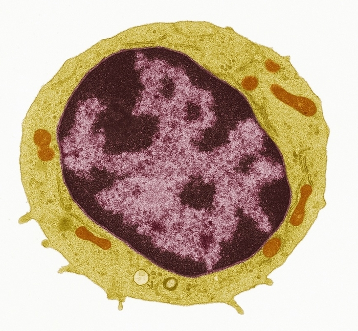 Lymphocyte, TEM Lymphocyte. Coloured transmission electron micrograph  TEM  showing the large central nucleus  brown  of a lymphocyte  white blood cell . Surrounding this is the cytoplasm  yellow , containing mitochondria  orange . Lymphocytes are cells of the human immune system. They are produced in bone marrow and mature in the thymus gland. T lymphocytes are susceptible to infection by the Human Immunodeficiency Virus  HIV , the causative agent of AIDS. There are three major types of white blood cells: granulocytes, lymphocytes and monocytes, which protect the body against invasion by foreign substances. Magnification: x13, 500 when printed 10 centimetres wide.