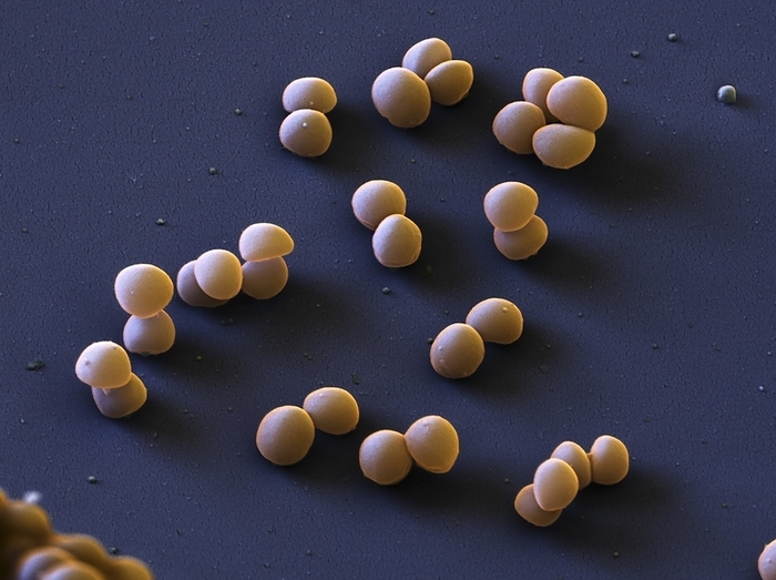 Staphylococcus lugdunensis bacteria, SEM Staphylococcus lugdunensis bacteria, coloured scanning electron micrograph  SEM . This Gram positive bacterium can occur harmlessly on human skin, but can also cause a wide range of serious infections in humans, including conditions such as septicaemia and wound infections. Magnification: x13,300 when printed at 10 centimetres across.