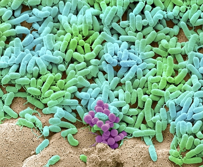 Bacteria found on dishcloth, SEM Coloured scanning electron micrograph  SEM  of bacteria cultured from a used dishcloth. Dishcloths can have six times as many bacteria as toilet handles according to some studies. They often harbour harmful E.coli bacteria, which can cause diarrhoea that can be fatal in vulnerable people. Many people fail to clean their dishcloth at a high enough temperature to kill commonly present bacteria such as Campylobacter, Salmonella, Staphylococcus, E. coli, and Listeria. Magnification: x5000 when printed at 10cm wide.