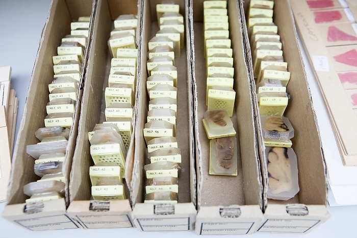 Tissue specimens, wax blocks Tissue specimens, wax blocks. Box of labelled and catalogued tissue specimens in a forensic laboratory. This is part of the process of preparing post mortem clinical specimens of human tissues for inspection and analysis by a forensic pathologist. The specimens are encased in wax, sliced, mounted on glass slides, dyed, and examined under a microscope.
