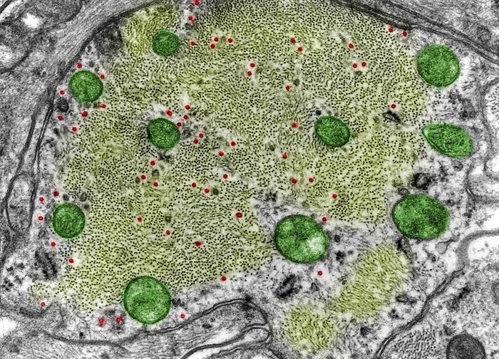 Intermediate glial filaments, TEM False colour transmission electron micrograph  TEM  showing many intermediate glial filaments  yellow  in an astrocyte process. Some mitochondria  green  and very few microtubules  red  may also be seen in the process.