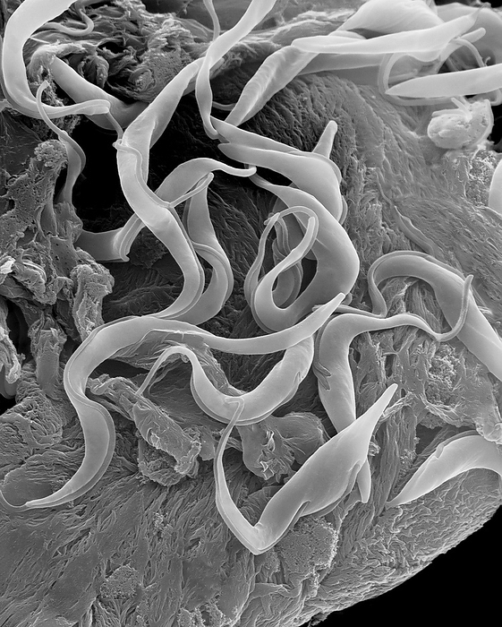 Trypanosome trypomastigote protozoan, SEM Trypanosome trypomastigote  Trypanosoma sp. , scanning electron micrograph  SEM . A parasitic hemoflagellated protozoan that causes trypanosomiasis  African sleeping sickness, Chagas disease . This trypanosome is a vector borne parasite transmitted by tsetse flies  Glossina spp. . The ribbon like flagellated trypomastigote is carried in the insects saliva  and faeces  and enters the human host through a wound made by the fly. This protozoan infects the blood, lymph and spinal fluid and rapidly divides. Upon entering the cerebral spinal fluid the parasite can damage brain tissue causing eventually causing death. Magnification: x800 when shortest axis printed at 25 millimetres.
