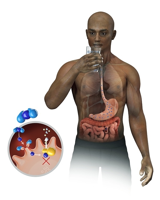 Cholera intestinal infection, illustration Cholera intestinal infection, illustration. Cholera is a bacterial infection of the small intestine that is transmitted via contaminated food or water. The bacterium Vibrio cholerae  blue, not to scale  is seen being ingested in a glass of water, down the oesophagus and into the stomach. This bacterium produces a toxin  dark blue  that affects the intestines  cutaway in abdomen, and inset at lower left , causing diarrhoea and severe dehydration  inset shows release of water molecules, H2O . These symptoms of the disease may be fatal if left untreated.