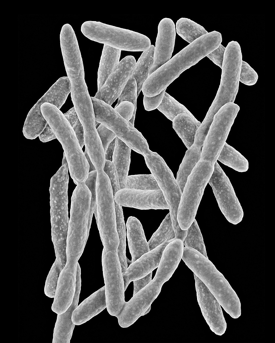 Flavobacterium akiainvivens, SEM Scanning electron micrograph  SEM  of Wood degrading bacterium  Flavobacterium akiainvivens . This bacterium was isolated by Iolani High School student  Hawaii, in Dr. Stuart Donachie s lab  from the Akia shrub  Wilkstroemia sp . Flavobacterium akiainvivens is a newly discovered bacterium  2013  that occurs on the endemic shrub in Hawaii. It is a Gram negative, rod shaped, non motile bacterium. Flavobacterium species are found in soil and fresh water in a variety of environments. Several species are known to cause disease in freshwater fish. Nylon degrading bacteria are a strain of Flavobacterium that are capable of digesting certain by products of nylon 6. Magnification: x5,335 when shortest axis printed at 25 millimetres.