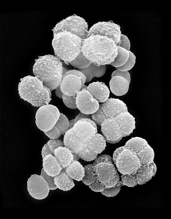 Deinococcus sp. coccoid prokaryote, SEM Scanning electron micrograph  SEM  of Deinococcus sp., Coccoid bacterium that is highly resistant to extreme environmental conditions. This species was isolated from an environment that had high levels of polyaromatic hydrocarbon compounds. It is known to degrade hydrocarbon compounds. Deinococcus sp. have thick cell walls that show gram positive staining, but they include a second membrane and thus are closer in structure to gram negative bacteria. Deinococcus radiodurans  former Micrococcus radiodurans  is an extremophile bacterium and is the most radiation resistant organism known. Magnification: x5,000 when shortest axis printed at 25 millimetres.