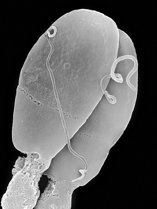 Treponema pallidum, SEM Scanning electron micrograph  SEM  of Treponema pallidum, Gram negative, spirochete bacterium. Two spirochetes are located on two sperm heads. Treponena is an obligate human parasite and is the causative agent of syphilis. Research indicates that the organism is microaerophilic and requires low concentrations of oxygen. It is a spirochete, a helical to sinusoidal  spiral shaped, corkscrew shaped  bacterium with outer and cytoplasmic membranes, a thin peptidoglycan layer, and periplasmic flagella. T. pallidum initially causes an ulcer  chancre  to develop at the site of infection. Over time, as the organism moves through the body, it causes damage to vital organs. It is transmitted from one infected person to another and is usually spread through sexual contact. Complications include blindness, mental illness, neurological disorders, and even death. Magnification: x4,000 when shortest axis printed at 25 millimetres.