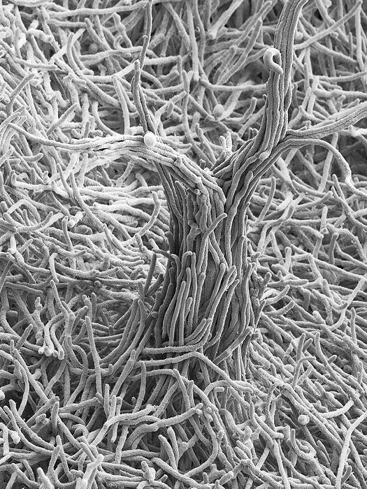 Soil fungus Exophiala spinifera, SEM Scanning electron micrograph  SEM  of Exophiala spinifera is a dermatiaceous fungus that is widely distributed in soil, plants, water and decaying wood material. E. spinifera initially grows as yeast like cells that are brownish to greenish black in colour. The yeast colonies then develop compact hyphae which form a velvety mycelium. The mycelium develops short tufts of aerial hyphae  shown here . As well as being a common saprophyte in nature, Exophiala spinifera can cause various human subcutaneous infections including: mycetoma, cutaneous phaeohyphomycosis and chromoblastomycosis. These infections are often associated with organ transplants. Magnification: x400 when shortest axis printed at 25 millimetres.
