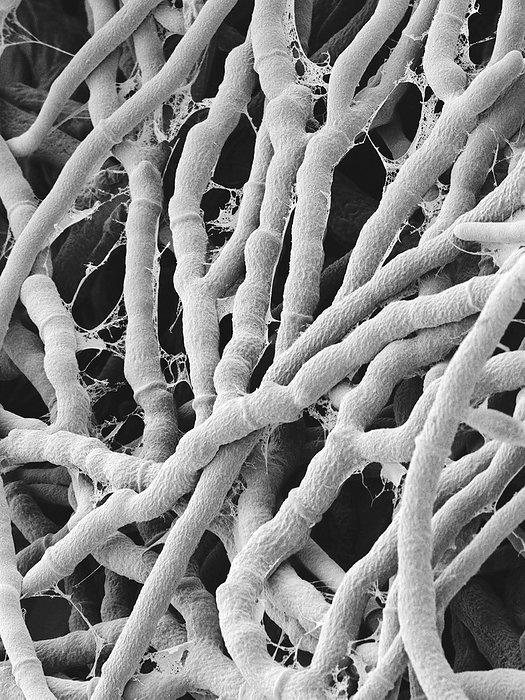 Basidiomycete Antrodia malicola, SEM Scanning electron micrograph  SEM  of Antrodia malicola is a basidiomycete bracket fungus in the family Meripilaceae. Shown here is the vegetative hyphae of the mycelium possessing distinct septae. Antrodia species have fruiting bodies that typically lie flat or spread out on the growing surface, with the hymenium exposed to the outside. The edges may be turned so as to form narrow brackets of these bracket fungi. Most species are found in temperate and boreal forests, and cause brown rot. Some of the species in this genus are have medicinal properties. The genus Antrodia includes some medicinal fungi such as Antrodia camphorata   this species in particular is a well known medicinal mushroom in Taiwan  known as Niu Chang . It is commonly used as an anti cancer, anti itching, anti allergy, anti fatigue and liver protective drug. Magnification: x535 when shortest axis printed at 25 millimetres.