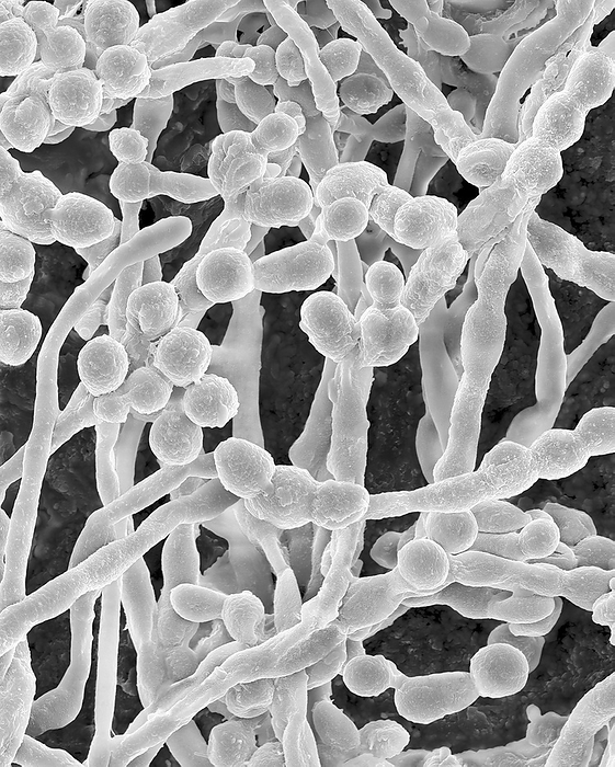 Mould  Cladosporium sp.  hyphae and spores, SEM Scanning electron micrograph  SEM  of the common environmental and allergenic mould  Cladosporium sp.   fungal hyphae producing spores. This genus is the most common airborne mould. Also known as Hormodendrum sp. This specimen was found on the inner surface of a building s air supply duct. This genus is the most common outdoor airborne mould but may occur in homes. It is an allergenic mould producing over 10 different types of antigens. The spores are easily made airborne and are a common cause of respiratory problems. It is frequently found at elevated levels in water damaged environments. Cladosporium can cause mycosis and extrinsic asthma  immediate type hypersensitivity: type I . Acute symptoms include oedema and bronchospasms, chronic cases may develop pulmonary emphysema Cladosporium spp. can also be associated with the spoilage of refrigerated meats. Magnification: x340 when shortest axis printed at 25 millimetres.