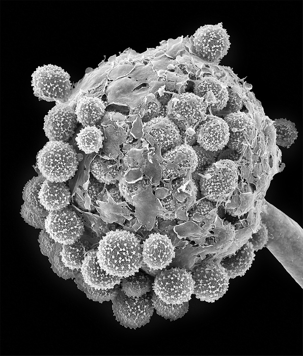 Fungus fruiting structure  Mucor spp. , SEM Scanning electron micrograph  SEM  of Mucor sp. fruiting structure with spores. The fruiting structure  condiophore  has matured and its outer membrane is disintegrating allowing the spores  conidia  to be released. Mucor is a common fungus found in many environments. It is a Zygomycetes fungus which may be allergenic and is often found as saprobes in soils, dead plant material  such as hay , horse dung, and fruits. Mucor is in house dust, air samples, and old dirty carpets, especially in water damaged moist building materials. Accumulated dust in ventilation ducts may contain high concentrations of viable Mucor spores giving rise to allergic or asthmatic reactions. It is an opportunistic pathogen and may cause mucorosis in immunocompromised individuals. The sites of infections are the lung, nasal sinus, brain, eye, and skin. Magnification: x400 when shortest axis printed at 25 millimetres.
