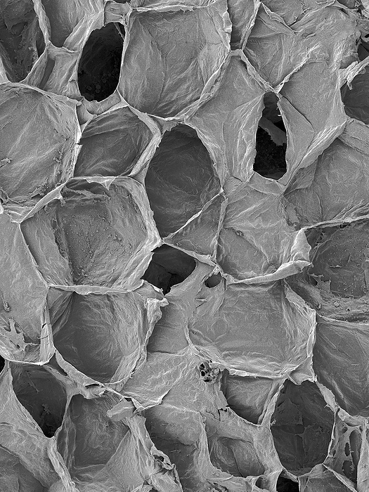Green bean parenchyma cells, SEM Green bean inner bean pod parenchyma cells  Phaseolus vulgaris  Blue Lake variety , scanning electron micrograph  SEM . Shown here is a fresh cut through the inner bean parenchyma cells. The cells are thin walled and form a compact, succulent tissue with only small intercellular spaces. The inner parenchyma cells contain numerous starch granules. These parenchyma cells surround the bean seeds in the string bean pod. Magnification: x105 when shortest axis printed at 25 millimetres.