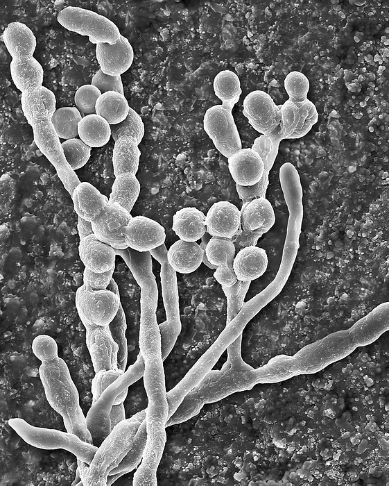 Mould  Cladosporium spp.  hyphae and spores, SEM Scanning electron micrograph  SEM  of the common environmental and allergenic mould  Cladosporium sp.   fungal hyphae producing spores. Also known as Hormodendrum sp. This specimen was found on the inner surface of a building s air supply duct. This genus is the most common outdoor airborne mould but may occur in homes. It is an allergenic mould producing over 10 different types of antigens. The spores are easily made airborne and are a common cause of respiratory problems. It is frequently found at elevated levels in water damaged environments. The genus Cladosporium includes over 30 species. Cladosporium can cause mycosis and extrinsic asthma  immediate type hypersensitivity: type I . Acute symptoms include oedema and bronchospasms, chronic cases may develop pulmonary emphysema Cladosporium spp. can also be associated with the spoilage of refrigerated meats. Magnification: x340 when shortest axis printed at 25 millimetres.